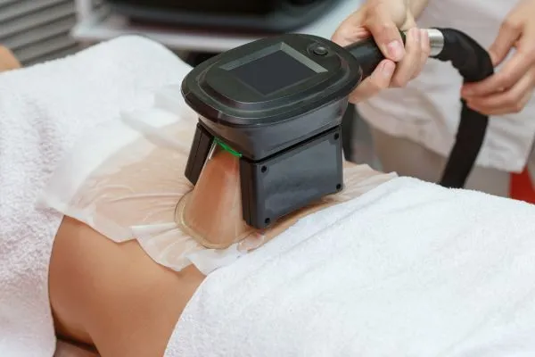Image of person having fat freezing treatment to help weight gain Greenock