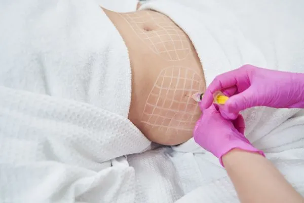 image of fat dissolving injections on love handles to help combat weight gain Greenock