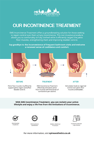 image to show how EMS treatment works for female urinary incontinence Greenock