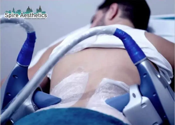 Man having fat freezing treatment done on love handles before a competitions Greenock to create a sculpted look.