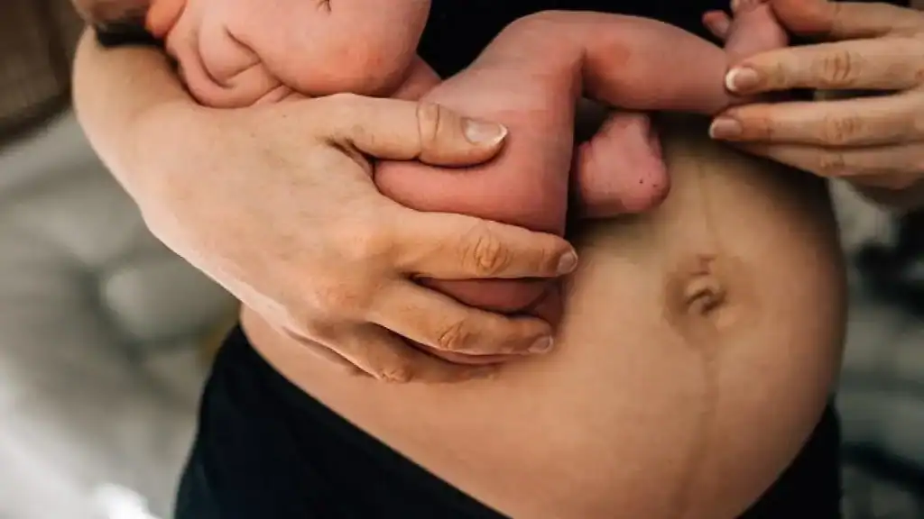 Why Is My Stomach Still Big After Pregnancy Greenock?