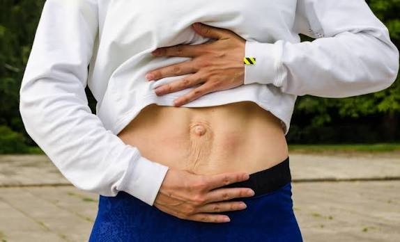When Could Diastasis Recti Be the Missing Piece of the Puzzle Greenock?